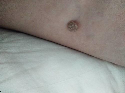 痣刺瓜怎么吃,解锁美味新体验