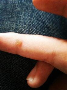 痣刺瓜怎么吃,解锁美味新体验